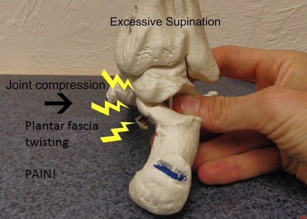 Foot supination - rear view