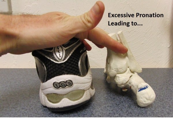 Foot and shoe position during pronation